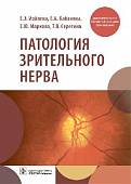 Патология зрительного нерва