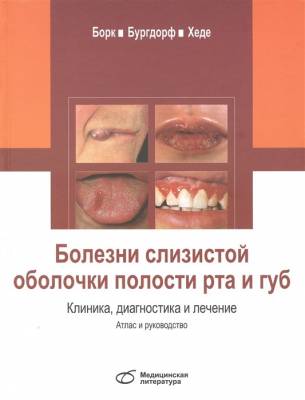Болезни слизистой оболочки полости рта и губ. Клиника, диагностика и лечение